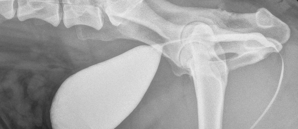 Pozitif kontrastlı sistografide bir divertikülün görünümü. Kırmızı daire, urakal anomalinin yerini gösterir