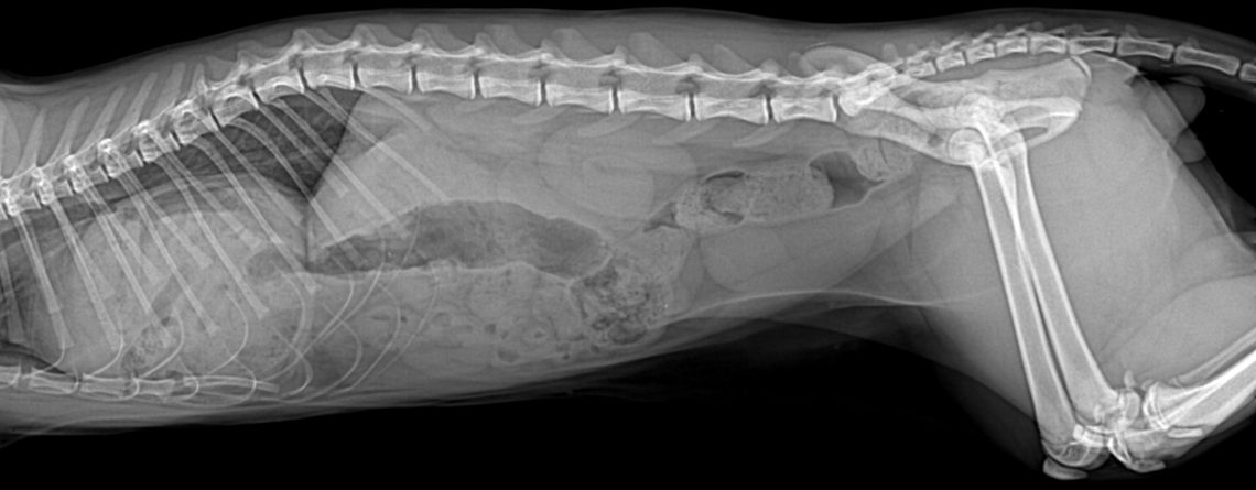 Peritonoperikardiyal Diyafram Fıtığı